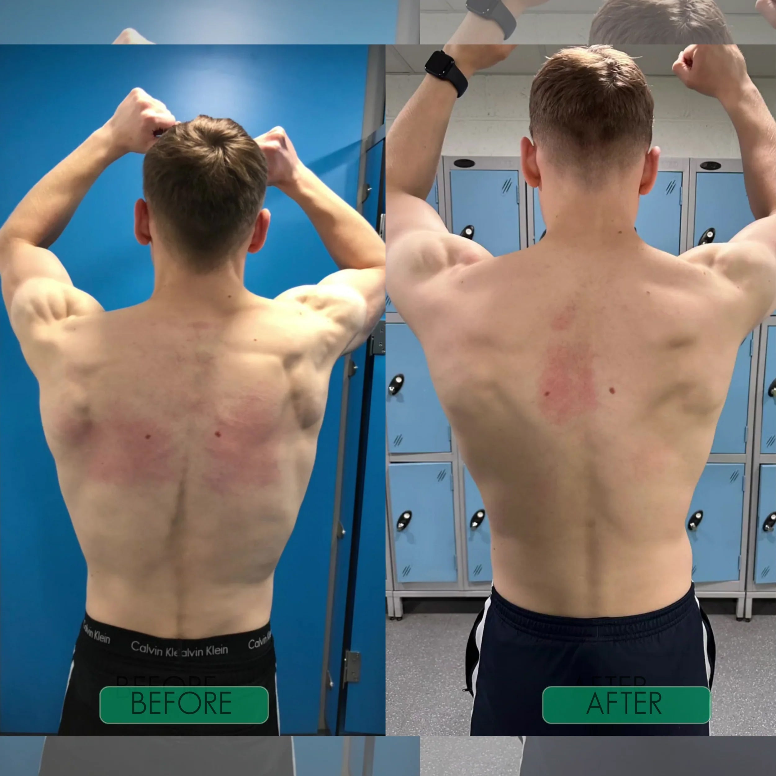 Postrixmer Posture Corrector For Seniors