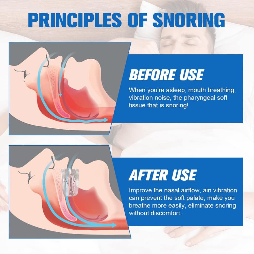Quietmex Anti Snoring Mouthpiece