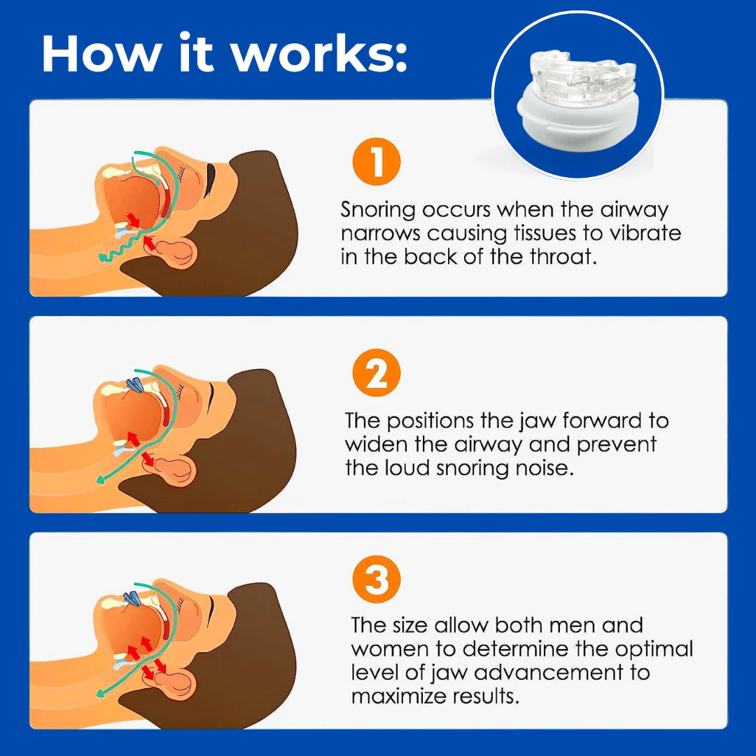 Quietmex Mouth Guard For Grinding Teeth