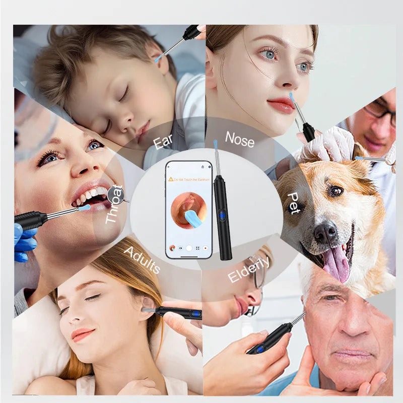 Wavixmora Ear Wax Removal Kit